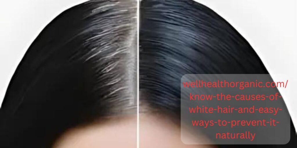 wellhealthorganic.com/know-the-causes-of-white-hair-and-easy-ways-to-prevent-it-naturally