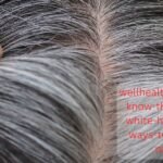 wellhealthorganic.com/know-the-causes-of-white-hair-and-easy-ways-to-prevent-it-naturally